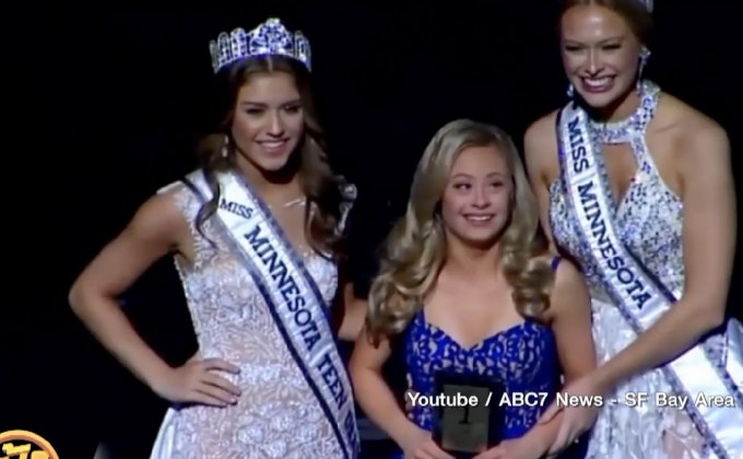 สาวดาวน์ซินโดรมคว้ารางวัลบนเวทีประกวดนางงาม