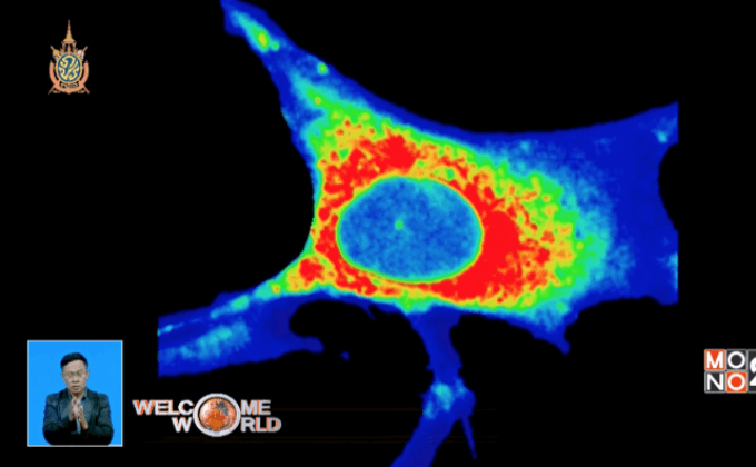 วินิจฉัยโรคด้วย “สีสะท้อนแสง”