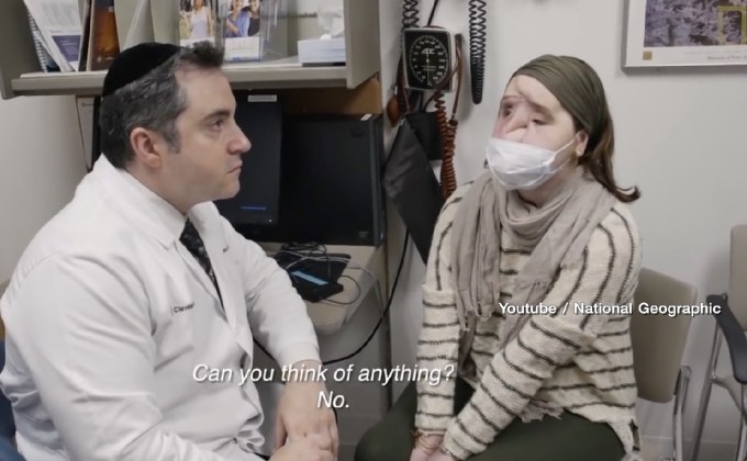 ผ่าตัดปลูกถ่ายใบหน้าสาวอเมริกัน