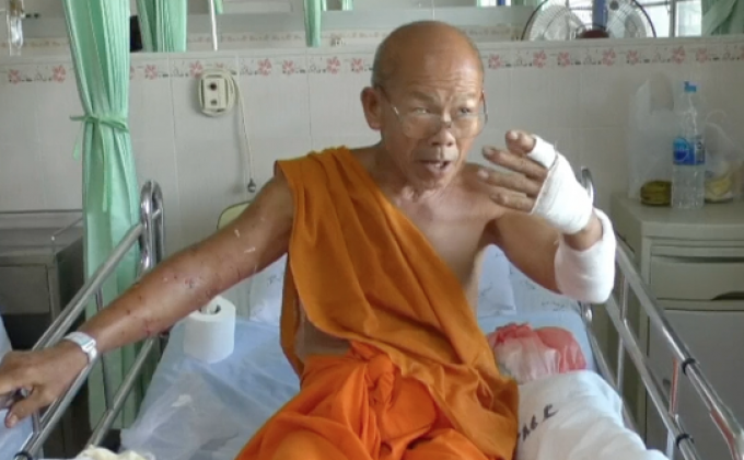 พิทบลูเกือบ 10 ตัว รุมกัดพระสงฆ์ขณะเดินบิณฑบาตร