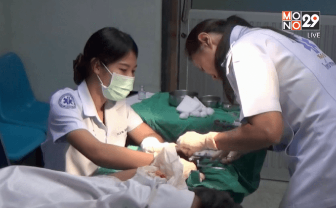 หนุ่มเล่นประทัดพลาดระเบิดใส่นิ้วชี้ขาด