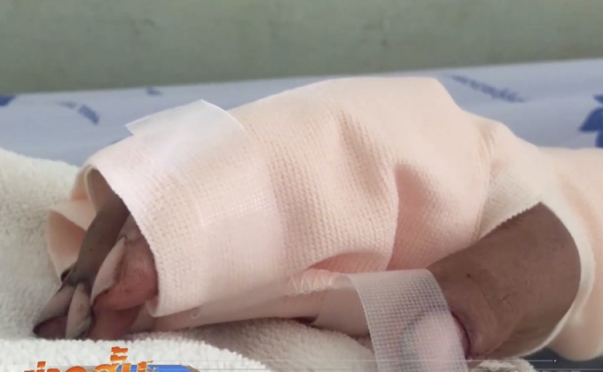 สุนัขบางแก้วกัดเจ้าของอาการสาหัส จ.บุรีรัมย์