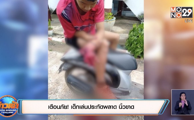 เตือนภัย! เด็กเล่นประทัดพลาด นิ้วขาด