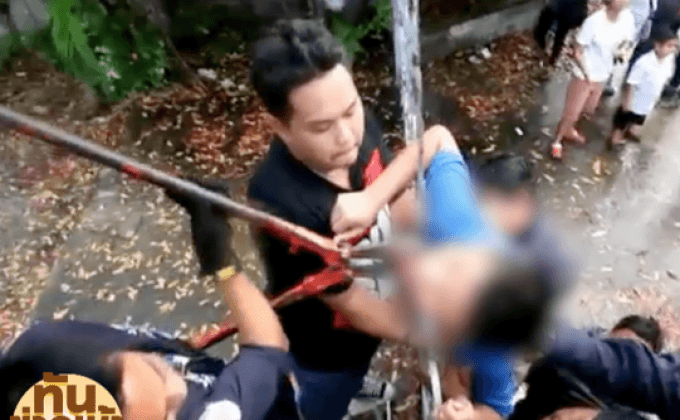 เด็ก 11 ขวบ ปีนรั้วบ้านพลาดถูกเหล็กเสียบคอทะลุปาก