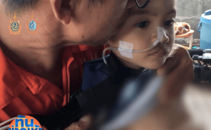 วอนช่วย “น้องจ่อย” เด็ก 5 ขวบ ป่วยประสาทลำไส้ไม่ทำงาน