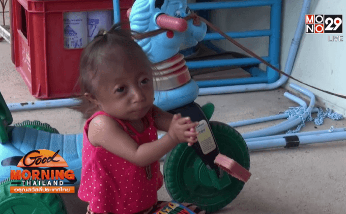 พบเด็กหญิงจิ๋ว 2 ขวบ สูงเพียง 48 ชม.
