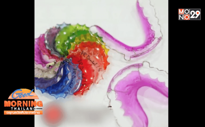 ใส่”รีเทนเนอร์” ไม่ได้มาตรฐาน อันตรายถึงชีวิต