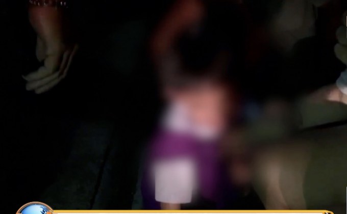 วอนแก้ไขฝาท่อระบาย หลังหนูน้อยตกขาติด