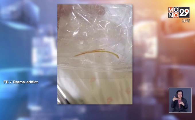 อุทาหรณ์ ! มหันตภัยก้างปลาทำลำไส้ทะลุต้องผ่าตัด