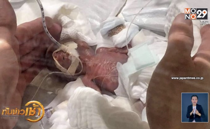 ทารกญี่ปุ่นตัวเล็กที่สุดในโลกกลับบ้านแล้ว