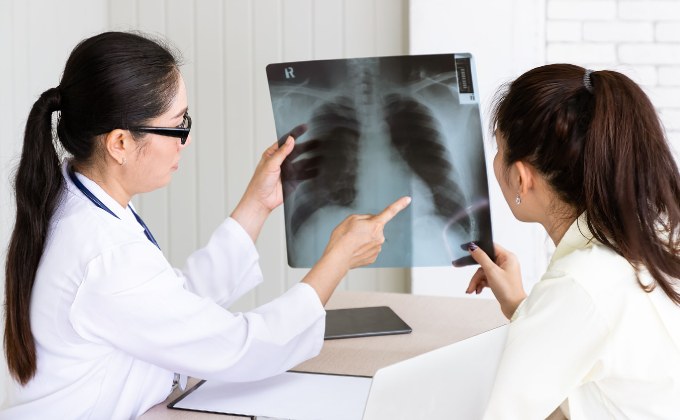 “ไอเรื้อรังอย่ามองข้าม!” หมอเตือนภัยเงียบ ‘มะเร็งปอด’ พบบ่อยแต่รู้ช้า รักษาไม่ทัน เสี่ยงเสียชีวิตไม่รู้ตัว