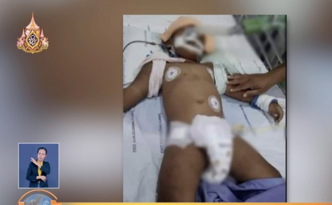 เด็ก 2 ขวบ ถูกพี่เลี้ยงทำร้าย เสียชีวิตแล้ว