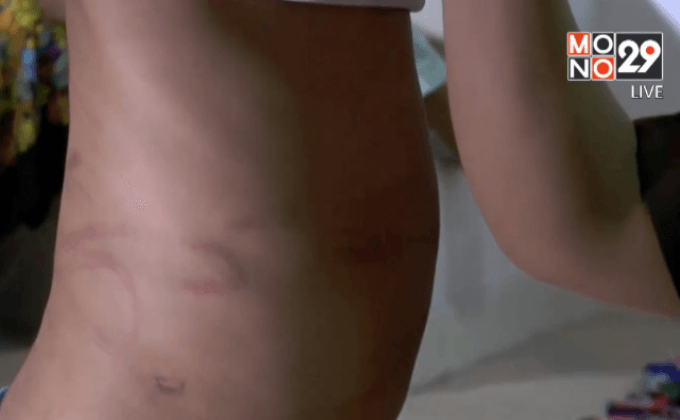 เด็ก 4 ขวบถูกกักขังและทำร้าย จ.ปทุมธานี