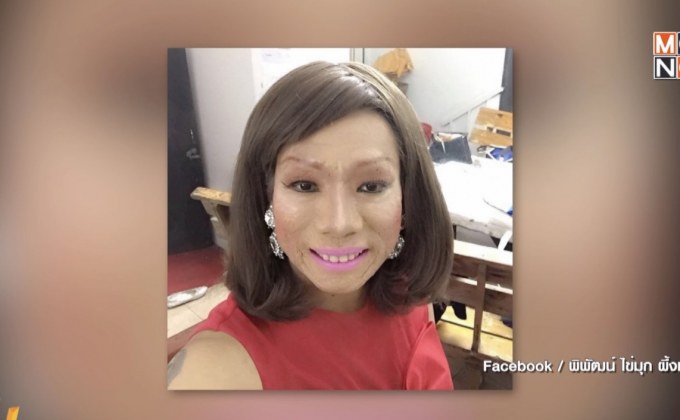 สุดยื้อ! “ไข่มุก ซุปตาร์” เสียชีวิตแล้วด้วยโรคมะเร็งผิวหนัง