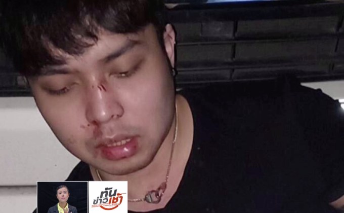 หลาน “สุเทพ” ขับเก๋งชนท้ายแท็กซี่ ก่อนถูกการ์ดรุมยำซ้ำ