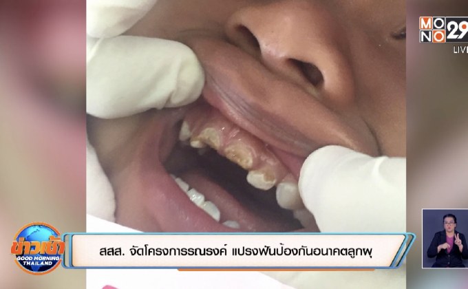 สสส. จัดโครงการรณรงค์ แปรงฟันป้องกันอนาคตลูกผุ