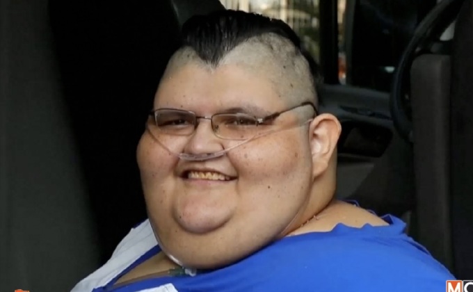 แพทย์เตรียมผ่าตัดชายเม็กซิกันอ้วนที่สุดในโลก