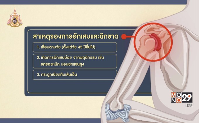 The Doctor เรื่องเล่าเรากับหมอ : ตอน กล้ามเนื้อไหล่เสื่อมสภาพ