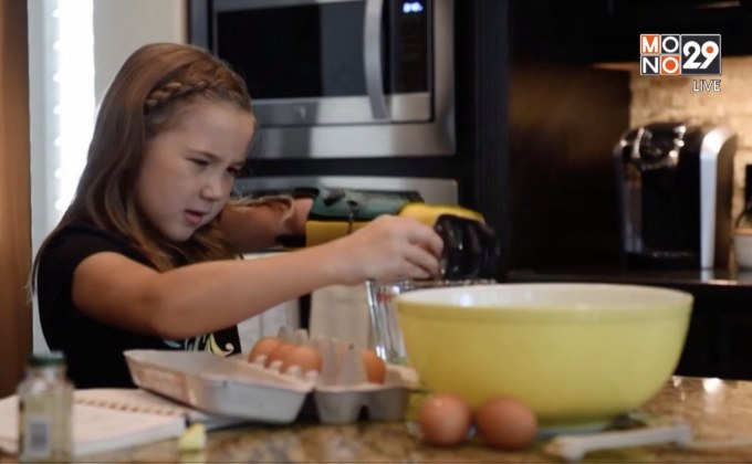 29 LifeSmart : GOOD HEALTH Hero Arm เปลี่ยนชีวิตเด็กหญิงชาวอเมริกัน