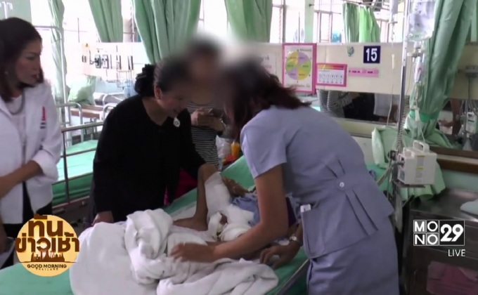 เร่งหาข้อเท็จจริง เด็ก 5 ขวบ ถูกสาดน้ำร้อน