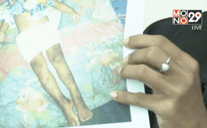 พ่อเลี้ยงโหดตีลูกสาววัย 2 ขวบ เสียชีวิต