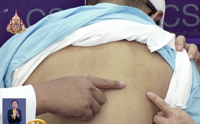 ทอ.ตั้งกรรมการสอบปมทำร้ายทหารเกณฑ์