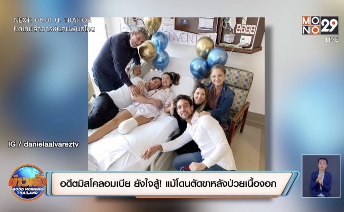 อดีตมิสโคลอมเบีย ยังใจสู้! แม้โดนตัดขาหลังป่วยเนื้องอก