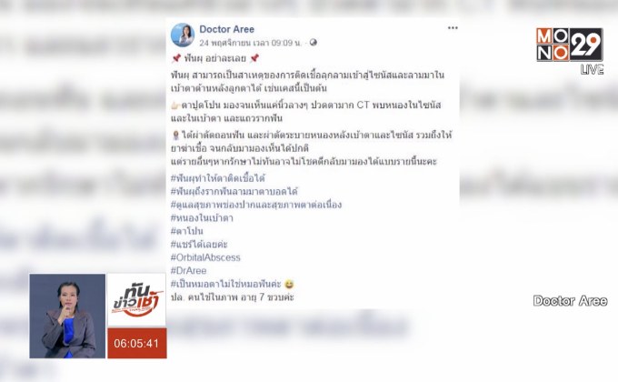 ​แพทย์เตือนปล่อยฟันผุนาน เสี่ยงติดเชื้อเสียชีวิต