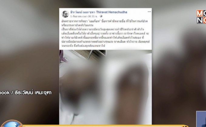 เตือนยาแก้ไมเกรน เสี่ยงอัมพฤต