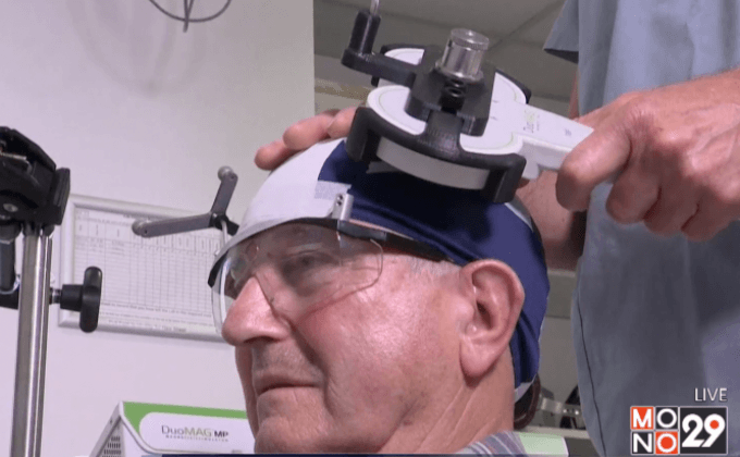 ใช้คลื่นแม่เหล็กกระตุ้นสมอง ตรวจหาโรคอัลไซเมอร์