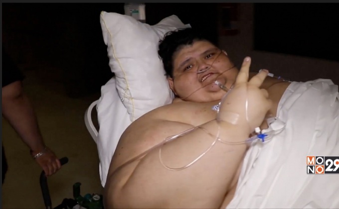 ชายหนักที่สุดในโลกฟื้นจากการผ่าตัด
