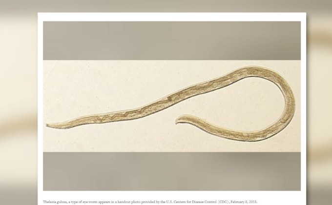 สหรัฐฯ พบพยาธิในตามนุษย์ครั้งแรก