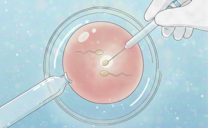 ICSI: พลิกโอกาส “มีลูกยาก” ลดความเสี่ยงมดลูกแตกซ้ำ เทคโนโลยีที่แม่ท้องต้องรู้!