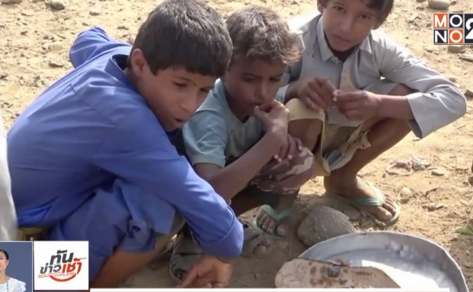 เด็ก 85,000 เสียชีวิตจากการขาดอาหารในเยเมน