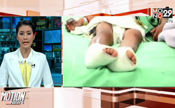 ตำรวจเตรียมพูดคุย “น้องดีเจ” หลังอาการดีขึ้น