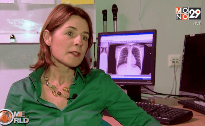 พบการติดเชื้อโรคระบาดในศตวรรษที่ 19 อีกครั้ง