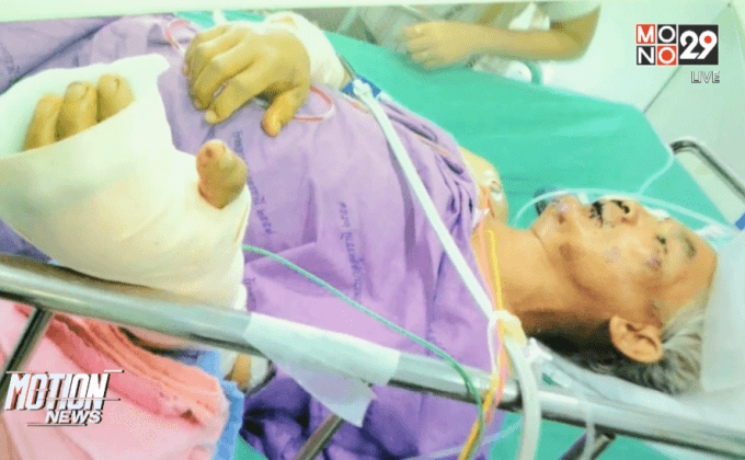 ร้องอดีต รปภ.ถูกหวย 30 ล้านดูแลคนเจ็บ