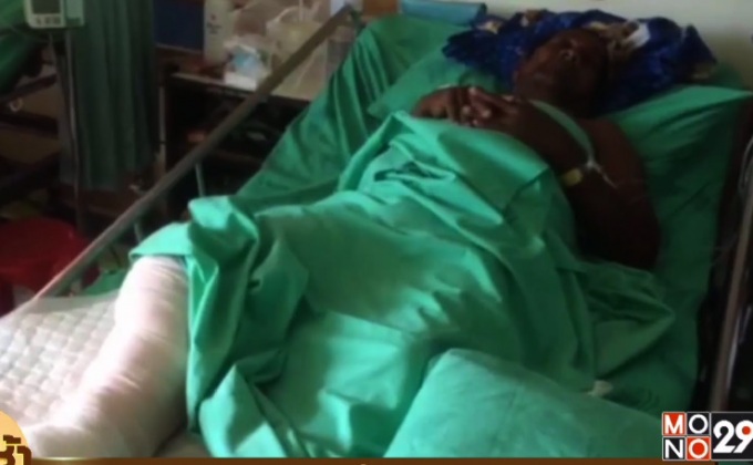 ลุงถูกแมวข่วนจนแผลติดเชื้อรุนแรง อาการยังน่าห่วง