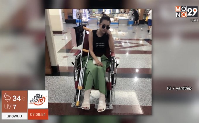 “หยาดทิพย์” ผ่าตัดด่วน! กระดูกเท้าหัก 2 ข้าง