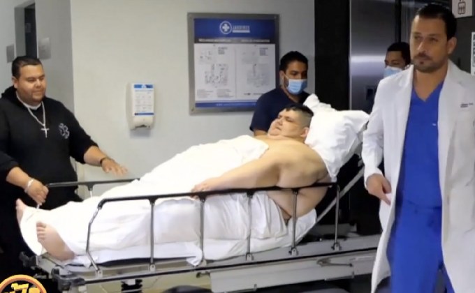 ชายอ้วนที่สุดในโลกเข้ารับการผ่าตัดลดน้ำหนัก