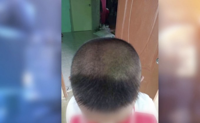 เด็ก ป.1 ร้องไห้โฮ ถูกตัดผมจนเสียทรง