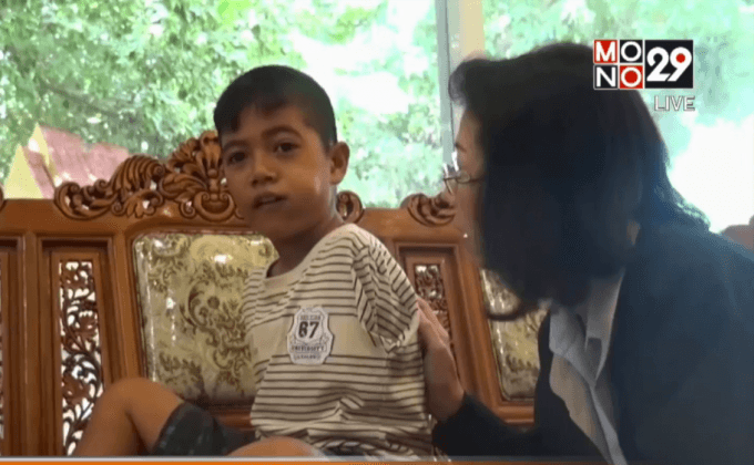 “น้องทาม” ยังไม่พร้อมใช้แขนเทียม