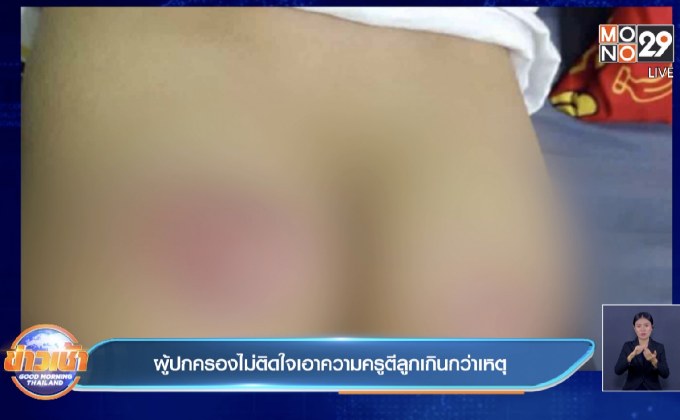 ผู้ปกครองไม่ติดใจเอาความครูตีลูกเกินกว่าเหตุ