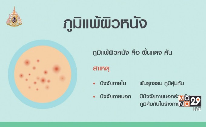 The Doctor เรื่องเล่าเรากับหมอ ตอน ภูมิแพ้ผิวหนัง