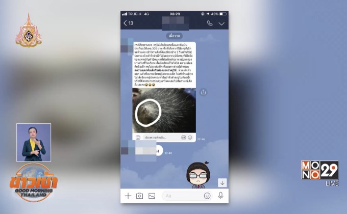 ย่าโวย! ครูตีหลานเลือดอาบ สั่งให้โกหก”โดนตะปูตำ”