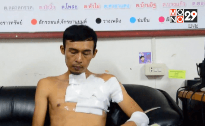 รวบหนุ่มโหดใช้น้ำมันราดจุดไฟเผาแฟนสาวสาหัส