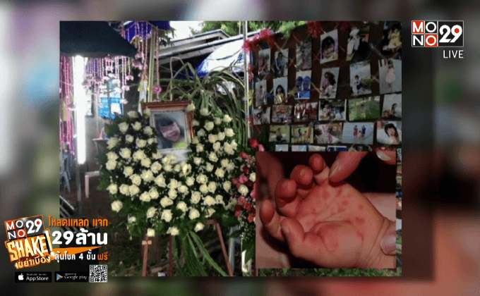 โรคมือ เท้า ปาก 3 วันตาย ?