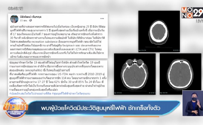พบผู้ป่วยโควิดมีประวัติสูบบุหรี่ไฟฟ้า ชักเกร็งทั้งตัว