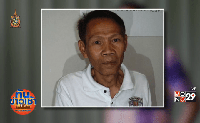 “ดอน จมูกบาน” ทรุด! มะเร็งตับระยะสุดท้าย