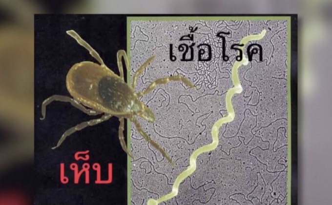 ระวัง “โรคลายม์”พบผู้ป่วยรายแรกในไทย